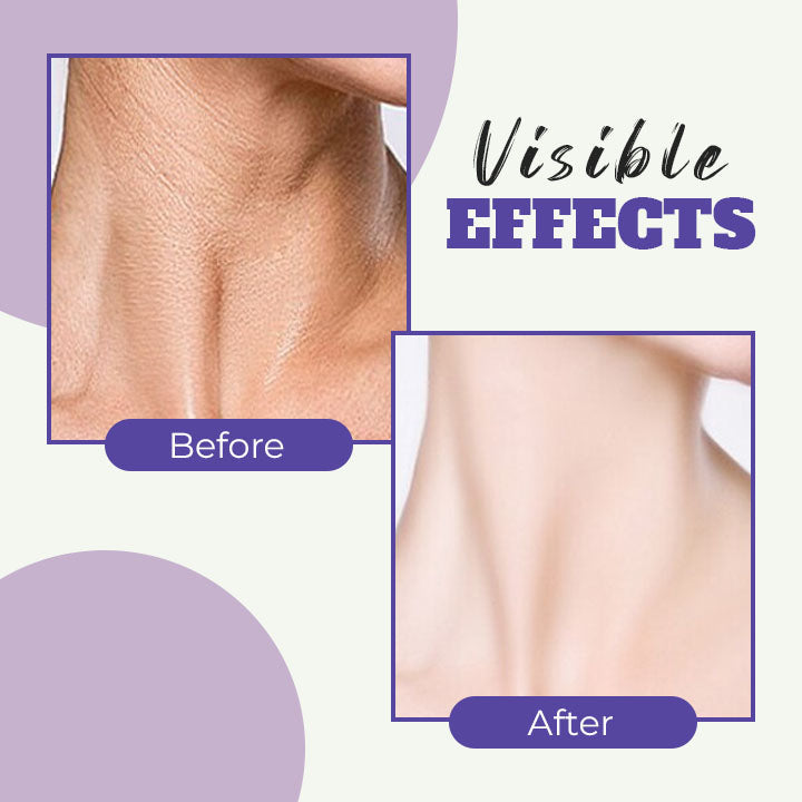 Retinol Neck Cream