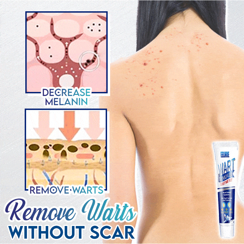 NEW!đInstant Blemish Removal Gel Women-002 DazzyCandy