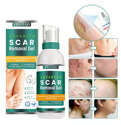 FivfivgoTM ScarRemove Advanced Scar Spray