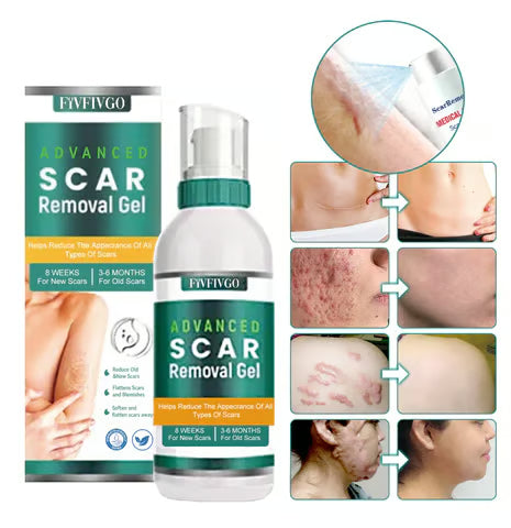 FivfivgoTM ScarRemove Advanced Scar Spray