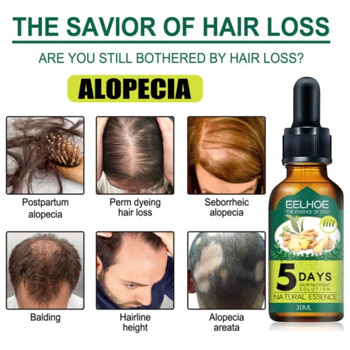 5 days Ruvine Hair Essence