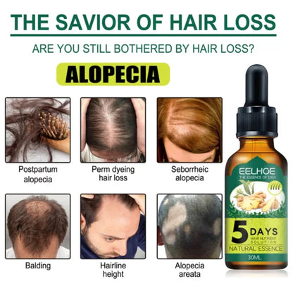 5 days Ruvine Hair Essence