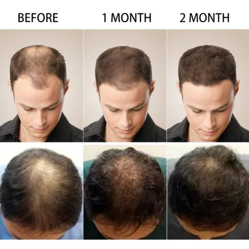 5 days Ruvine Hair Essence