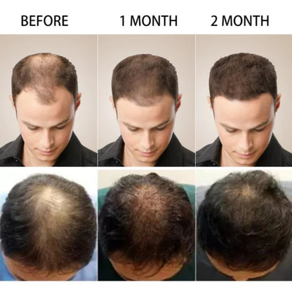 5 days Ruvine Hair Essence