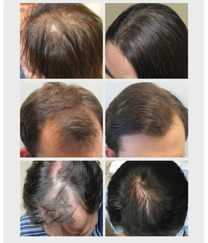 5 days Ruvine Hair Essence