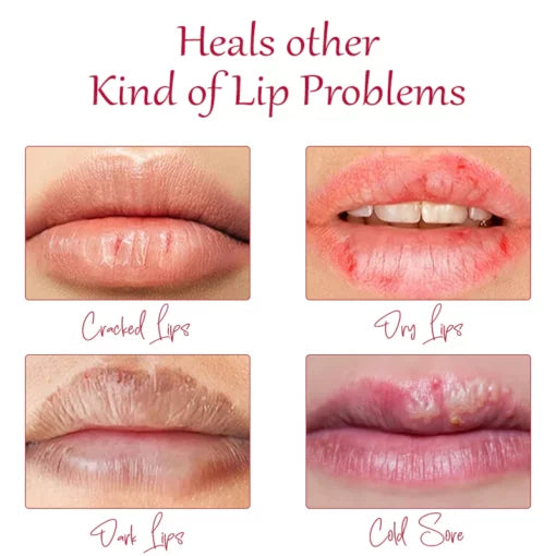 ATTDX Day and Night Honey Moisturizing Lip Oil
