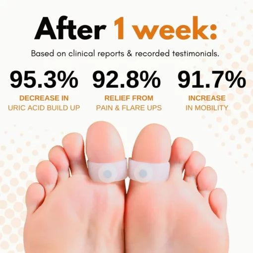 AcuHealth™ toe rings for gout relief