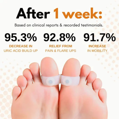 AcuHealth™ toe rings for gout relief