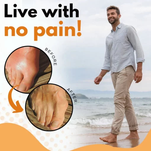 AcuHealth™ toe rings for gout relief