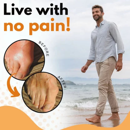 AcuHealth™ toe rings for gout relief