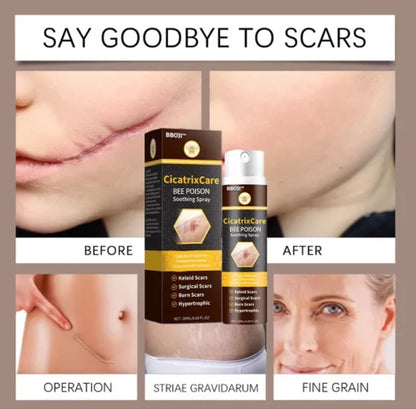BBOJI™️ CicatrixCare Bee Venom Therapy Spray