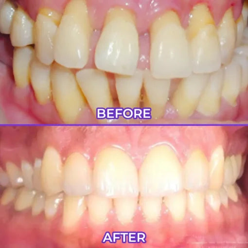 Biancat® SensiGum Fluoride Toothpaste