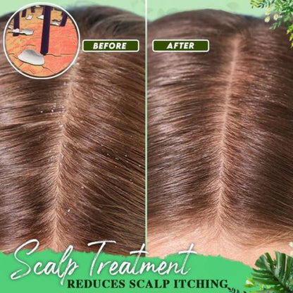 Essence for treating dandruff
