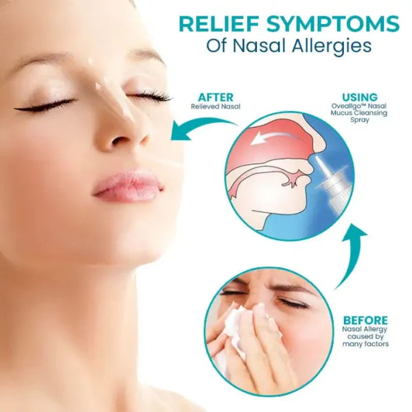 Fivfivgo™ Nasal Mucus Cleansing Spray