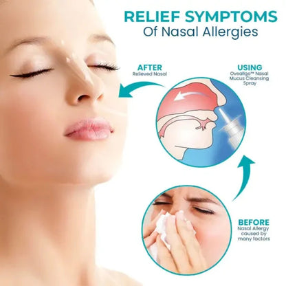 Fivfivgo™ Nasal Mucus Cleansing Spray