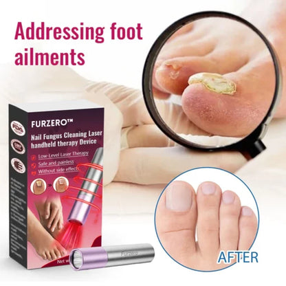 Furzero™ laser handheld therapy device for nail fungus treatment