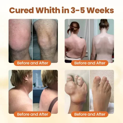 NovaRX® Premium Curcumin Pain Relief Gel