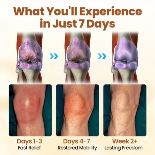NovaRX® Premium Curcumin Pain Relief Gel
