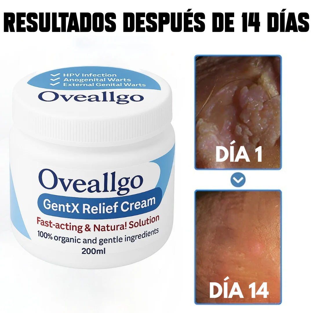 Oveallgo GentX® Eczema Cream.