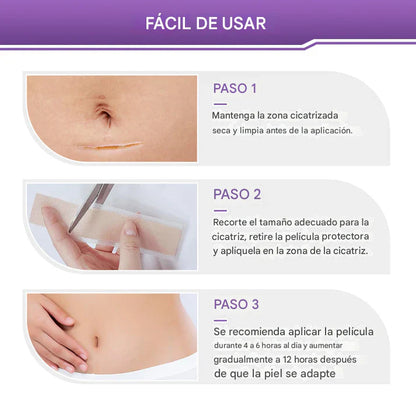 Oveallgo® Hyaluronic Acid Nano Microneedle Repair Tape