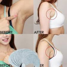 Oveallgo™ Lymphatic Drainage Patches for lymphatic care