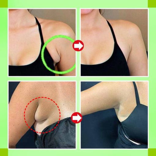 Oveallgo™ Lymphatic Drainage Patches for lymphatic care