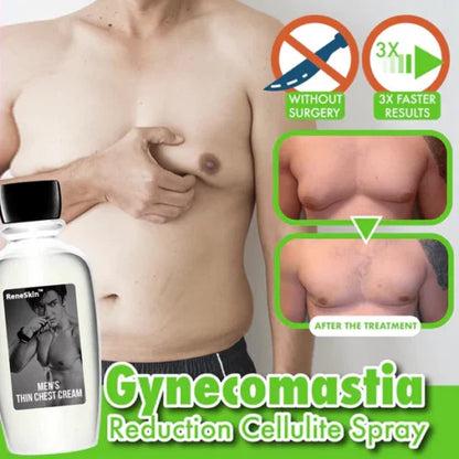 ReneSkin™ anti-cellulite cream for reducing gynecomastia