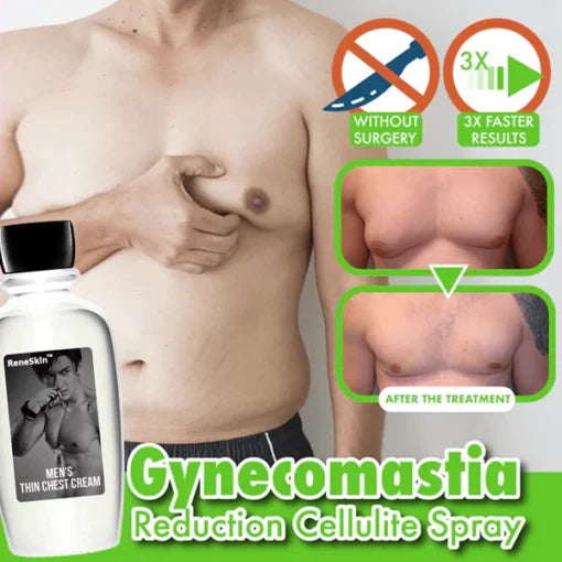 ReneSkin™ anti-cellulite cream for reducing gynecomastia