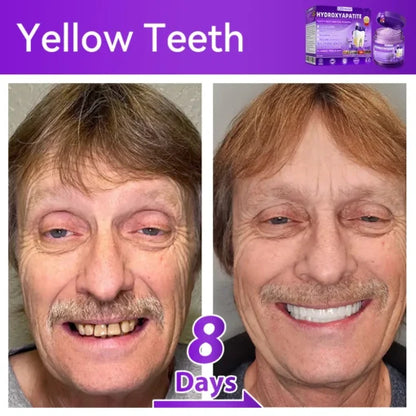 Teeth whitening powder