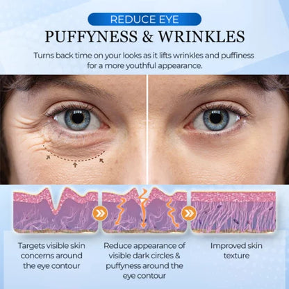 EyeZen™ 4D Airbag Vibrating Eye Massager