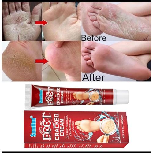 SUMIFUN Cracked Cream 20g – Repair Cream for Cracked Hands and Feet