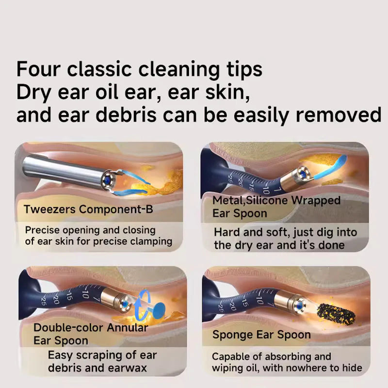 ⏳50%OFF⏳ Visual Arc Ear Wax Removal Kit
