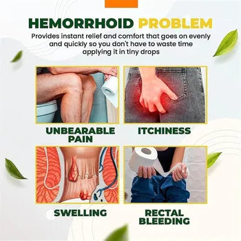 Hemorrhoid capsules made from natural herbs